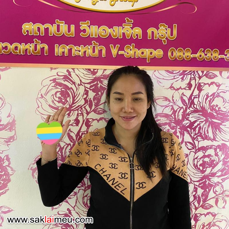 รีวิวรูปภาพ